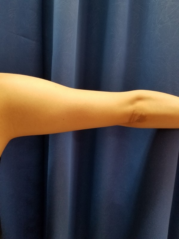 二の腕カバー タルミ シミ隠し 楽ちんスタイルアップ 社交ダンス用インナー ベージュ ブラック ドレスインナー背あきタイプ